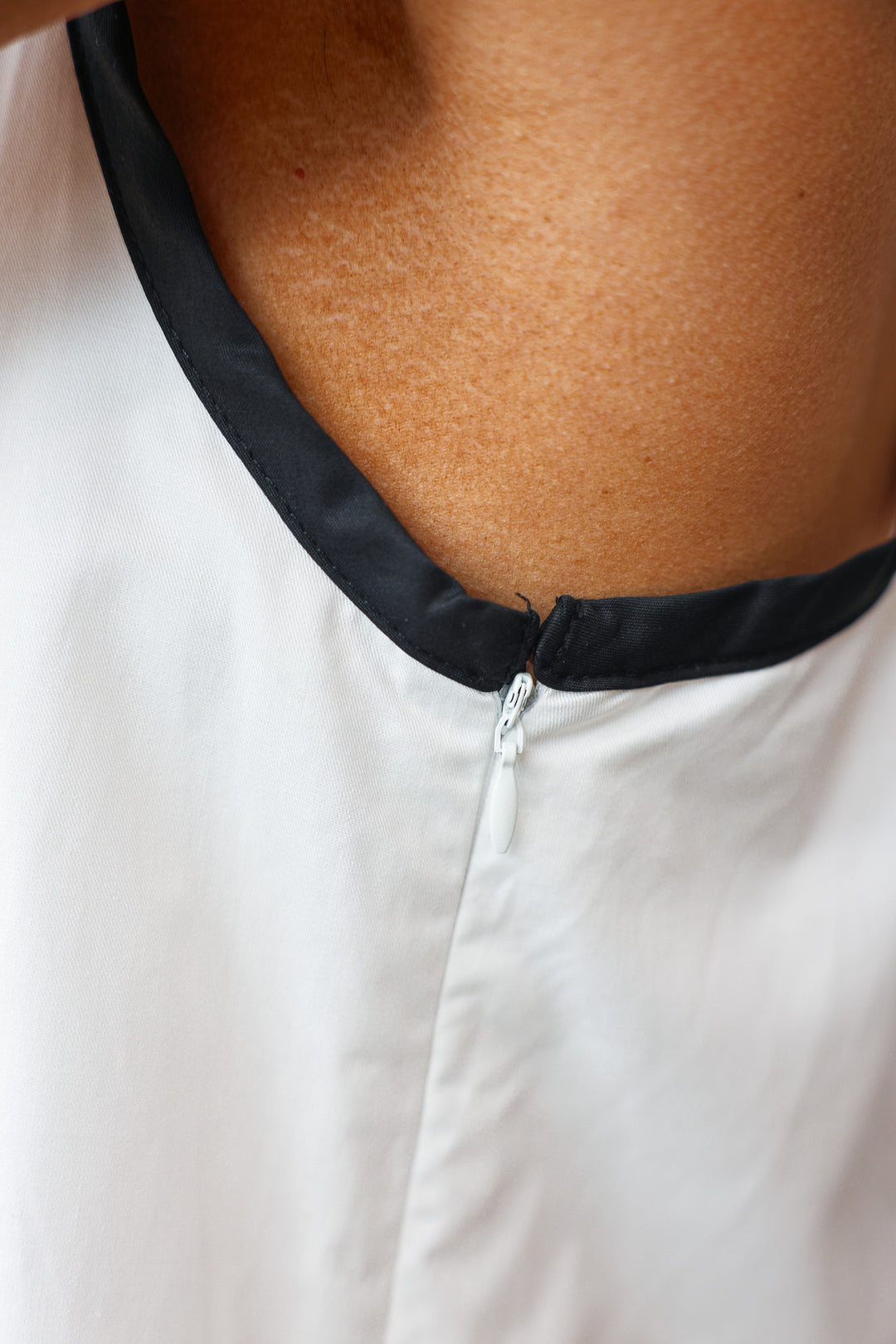 Scallop Hem Dress - Black/White